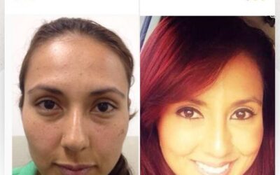 Elimina tus ojeras de manera rápida y simple.