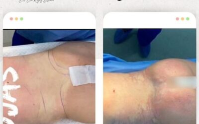 Dr. Eric Rojas