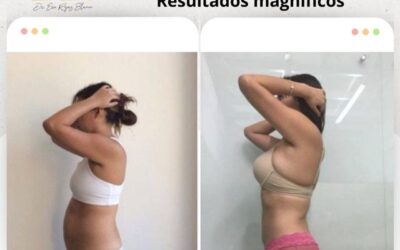 lim Láser, increíbles cambios en tu cuerpo.