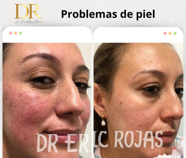 Solucionamos todos tus problemas de piel.