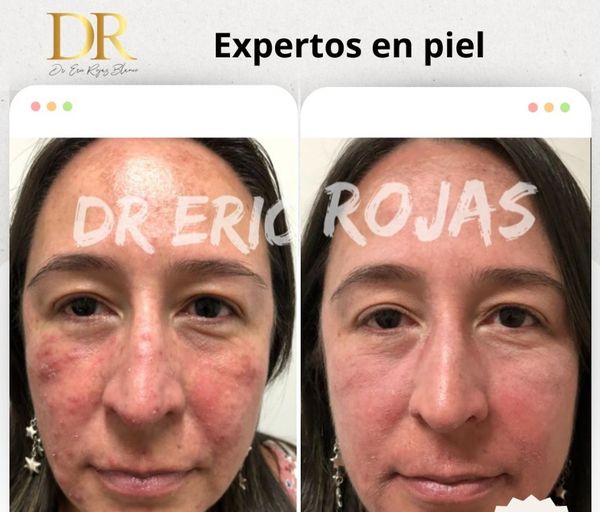 Resolvemos tus problemas de piel.