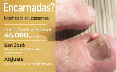 Tenemos la solución definitiva para las uñas encarnadas