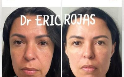 Dr. Eric Rojas