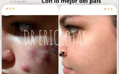 Mejoramos tu rostro.