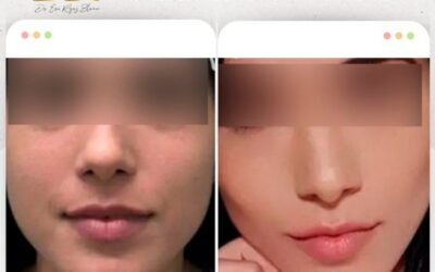 Perfilado facial.😉
