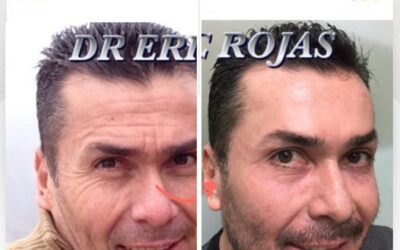 Rejuvenece tu rostro y luce increíble.
