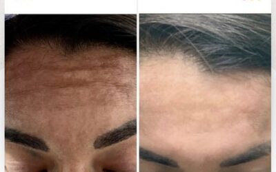 Limpia tu rostro de las manchas.