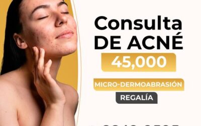 Regalía para nuestros pacientes de acné | Todo este mes regalía.