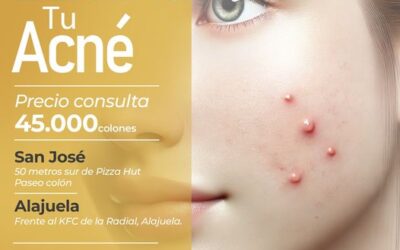 ¡Vive sin acné! Inicia el 2025 SIN acné.