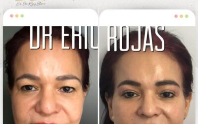 Dr. Eric Rojas