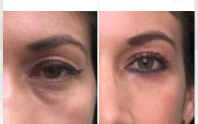 ¡Renueva tu rostro con nuestros procedimientos!