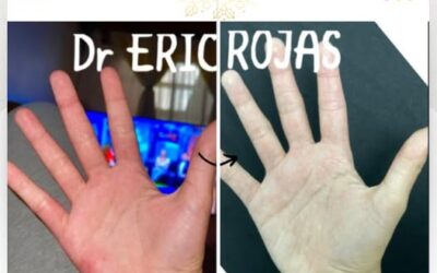 Soluciona tus problemas de piel con los mejores, te esperamos.