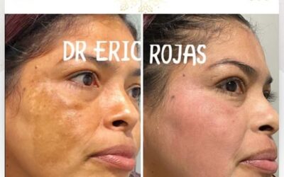 ¡Elimina las manchas de tu vida!