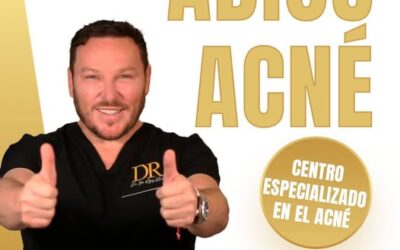 Adios acné