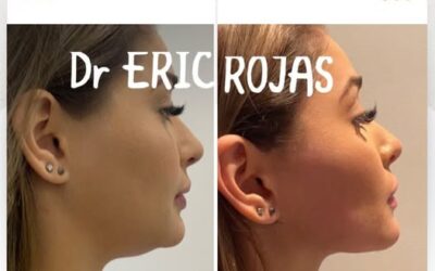 Dr. Eric Rojas
