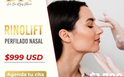 ¡Rinolift!, luce tu perfil con nuestro método.