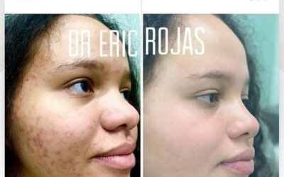 Dr. Eric Rojas