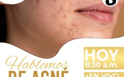 ¡Hablemos de acné! | ¿Tienes un nuevo brote?