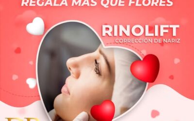 ¡Rinolift para este mes de los enamorados!