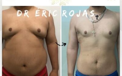 Dr. Eric Rojas