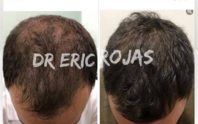 Dr. Eric Rojas