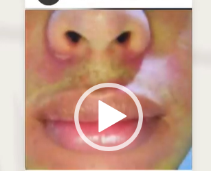 Dr. Eric Rojas
