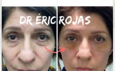 Dr. Eric Rojas