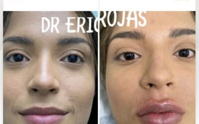 Dr. Eric Rojas
