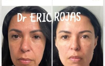 Dr. Eric Rojas