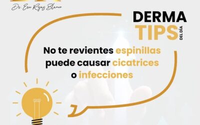 ¡Cuidado con «travesear» las espinillas!