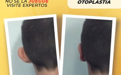 Es momento de dejar complejos gracias a nuestro procedimiento.