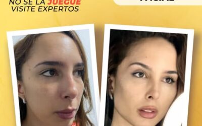 ¡Adios a los surcos!