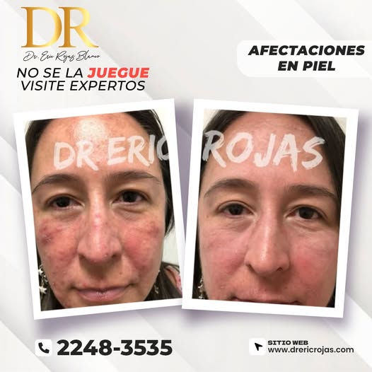 Dr. Eric Rojas