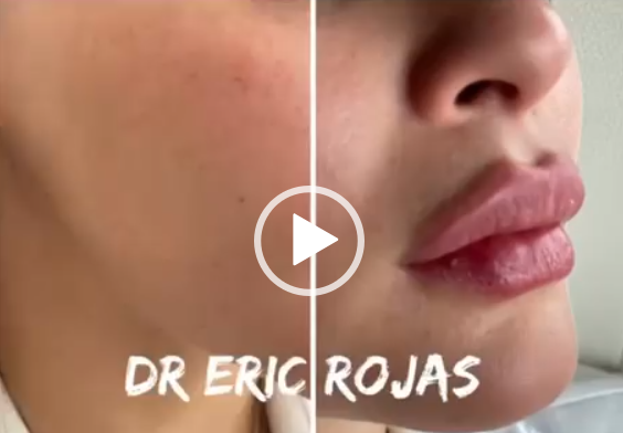 Dr. Eric Rojas