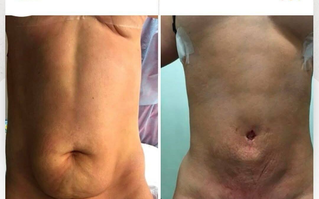 Dr.Eric Rojas