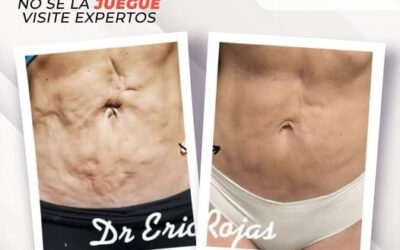 Dr. Eric Rojas