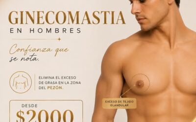 Ginecomastia