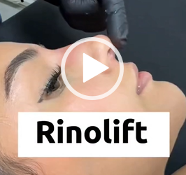 RenoLif