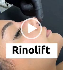RenoLift