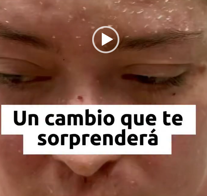 Muchas veces los problemas de piel pueden generar baja autoestima hasta depresión