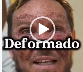 DEFORMADO?