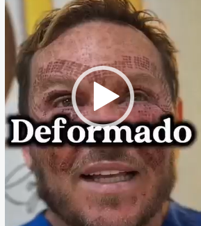 DEFORMADO?