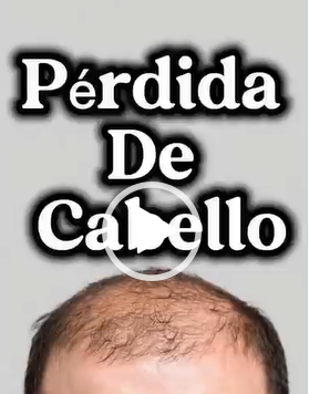 ¿Notas que estás perdiendo más cabello de lo normal?