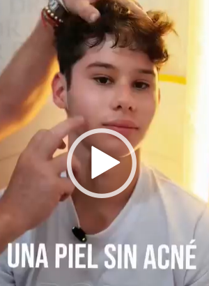 Una piel sin acné es posible