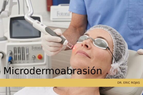 Microdermoabrasión: exfoliación profunda de precisión médica