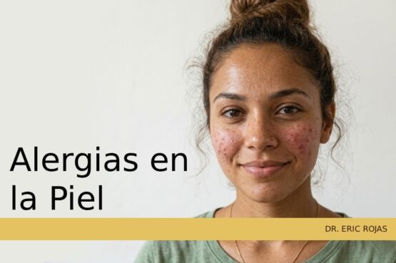 Diagnóstico y tratamiento dermatológico especializado para las alergias en la piel