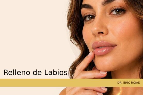 Diseño y embellecimiento de labios con ácido hialurónico