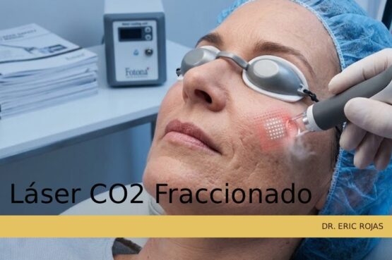 Renovación cutánea intensiva con láser para atenuar arrugas profundas y cicatrices