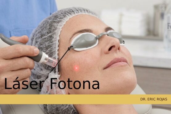 Láser Fotona: tecnología multipropósito para regenerar las capas profundas de la piel