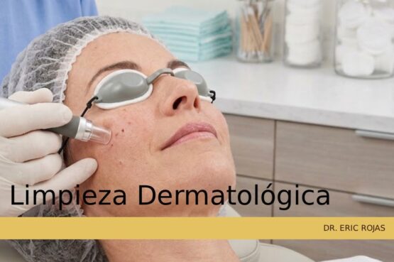 Limpieza facial profunda de grado médico